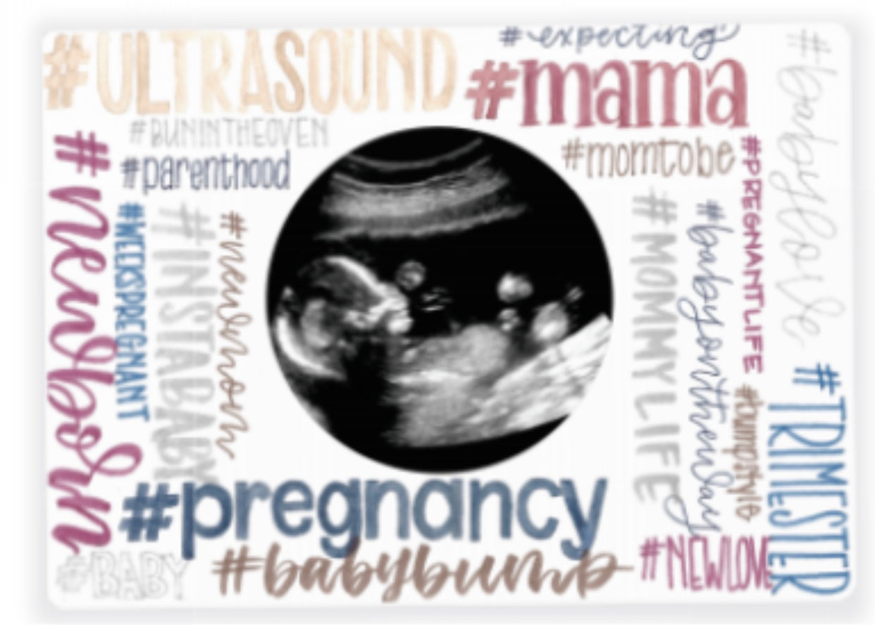 Magnetic Ultrasound Frame