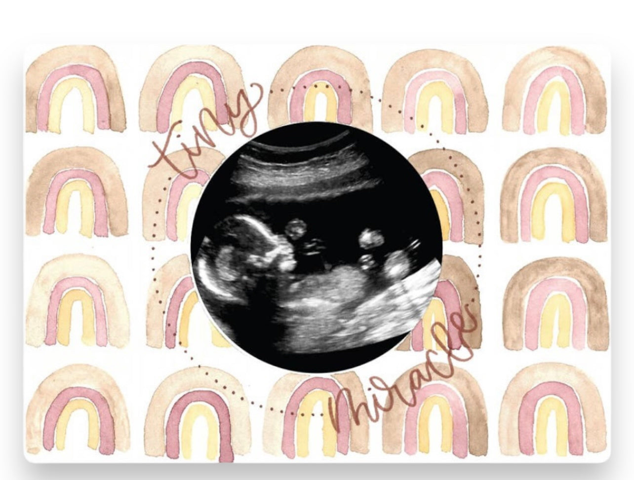 Magnetic Ultrasound Frame
